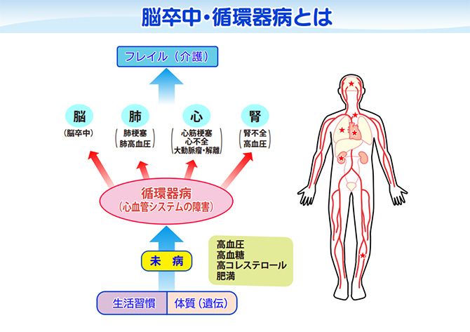 脳卒中・循環器病とは